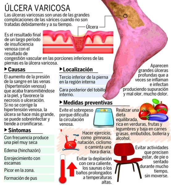 Infografía Gneaupp 5760