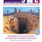 A etiological treatment of venous leg ulcers with compression therapy: real‑life outcomes with two different procedures