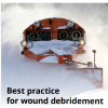Best practice for wound debridement