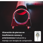 Ulceración de piernas en insuficiencia venosa y arteriovenosa Evaluación y manejo con terapia de compresión